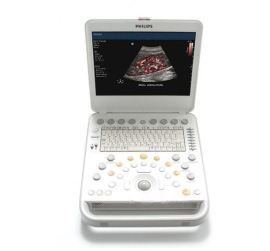 Portable Ultrasound Machine